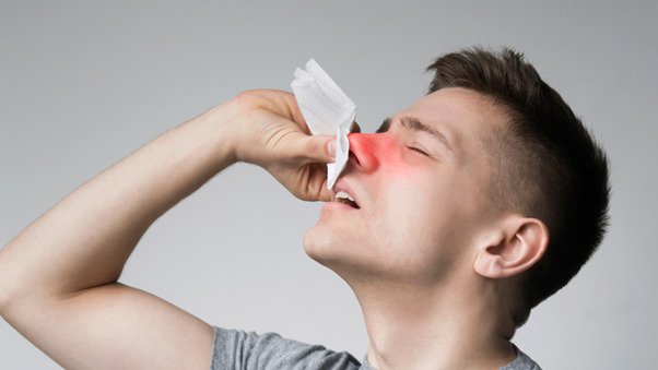 Sinusitis Explained Causes, Symptoms, and When to Seek Help